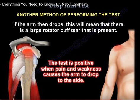 drop arm test shoulder|drop arm test positive means.